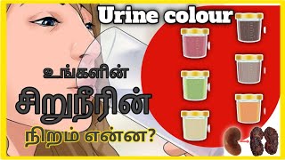 Urine colour change reason tamil  Kidney failure symptoms in tamil  urine colour changes tamil [upl. by Madelin]