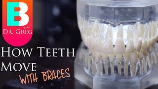 BRACES EXPLAINED How Teeth Move  Braces Work [upl. by Rezzani]