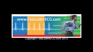 Understanding the normal 12lead ECGEKG [upl. by Gratiana62]