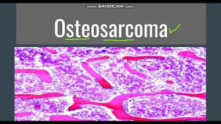 Osteosarcoma GeneralMorphology SubtypesClinical features [upl. by Florinda]