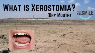 What is Xerostomia [upl. by Kryska]