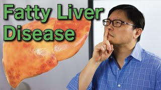 How to Reverse Fatty Liver Disease Naturally  Jason Fung [upl. by Aneehsit]