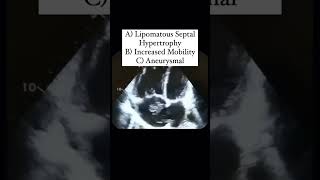 Interatrial Septum Quiz echocardiography [upl. by Nemajneb17]