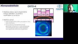 SEMANA DE LA VISIÓN  ORTOK [upl. by Theobald]