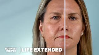 Scientists Are Closer Than Ever To Reverse Aging How Does It Work  Life Extended [upl. by Aicirpac]