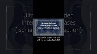 Ultrasound Guided Interventions Cases Ischial Bursitis Injection [upl. by Krum]