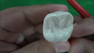 Maxillary Permanent First Molar Morphology [upl. by Zampino]