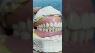 Complete Denture Ready For Flasking 😁😁😁dentures dentalartbyhaider [upl. by Marvella414]