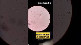 Sperm cell under microscopesubscribembbsmltlifedailyvlogmedicalstudentshortsvideodmlt [upl. by Dana]