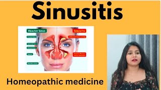 Sinusitis treatment  Sinusitis symptomscauses amp homeopathic medicine in hindi  Sinus infection [upl. by Melamie]