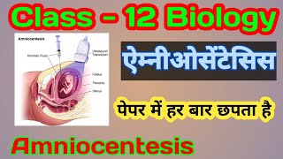 ऐम्नीओसेंटेसिस  Amniocentesis Class 12th Biology Very Important Question [upl. by Revolc]