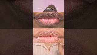 Dark lips remedy naturalremedy malluvlogger malayalambeautytips malayalambeautychannel lipcare [upl. by Aihsik]