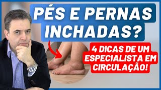 Pés e pernas inchadas  Causas e 4 dicas importantes  Dr Alex Vascular [upl. by Campbell]