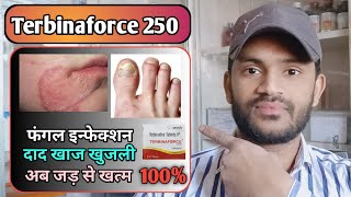 Terbinaforce 250 tablet use dose benefits and side effects full review in hindi [upl. by Aryhs]