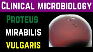 Proteus Mirabilis amp Vulgaris ClinicalPathogenesisInvestigationTreatmentPrevention  Dr Mubashar [upl. by Alleinnad]