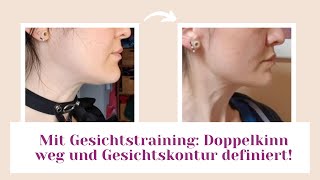 Doppelkinn weg und Gesichtskontur definiert mit Gesichtstraining [upl. by Sihon]