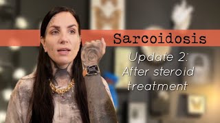 Sarcoidosis update 2 After topical steroid treatment [upl. by Rogerio]