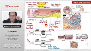 Residentado Villamedic Cardiopatía isquémica [upl. by Eceirahs]