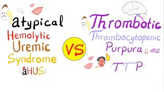 Atypical Hemolytic Uremic Syndrome aHUS vs Thrombotic Thrombocytopenic Purpura TTP [upl. by Valenba401]