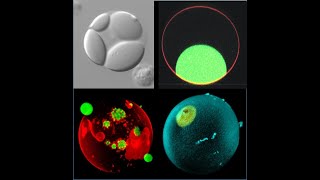 Rumiana Dimova Membrane remodeling in artificial cells when a membrane meets a drop [upl. by Alat678]