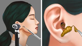 ASMR  Satisfying Ear Cleaning and Earwax Removal  ENJO Relaxing [upl. by Chamkis]