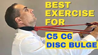 Best Exercises For C5 C6 Bulging Disc  C5 C6 Herniated Disc Exercises by Dr Walter Salubro [upl. by Noired479]