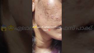 😱ഏലാദി ചൂർണ്ണം ഫേസ് പാക്ക് Day 7 facepackforacne facepackforglowingskin facepackforteenagers [upl. by Animahs]