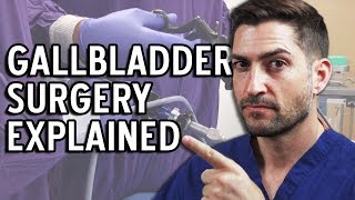 Gallbladder Surgery Explained  Complications and Recovery [upl. by Ailenroc834]