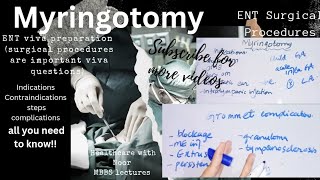 myringotomy  tympanostomy  ent surgical procedures  brainlessmedicos580 [upl. by Lexerd261]