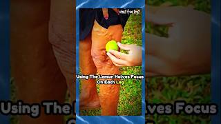 Quick Fix for Varicose Veins Simple Home Remedy🔥 naturalboost [upl. by Eneluj]