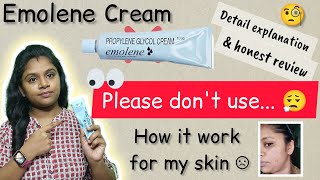 Emolene cream users 😵  dont use 😮‍💨  0 result for oily skin type niruscrown [upl. by Obelia]