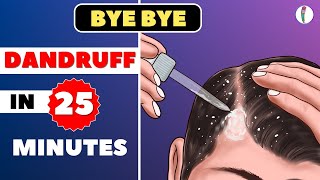 🔥1 Dandruff Treatment at Home  How to get rid of Dandruff  Dandruff Removal  Itchy scalp [upl. by Anwahsar909]