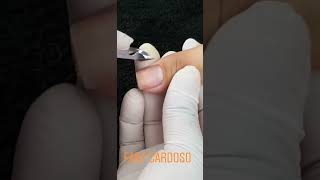 Cutilagem para manicure iniciante nails profissaomanicure nailart [upl. by Lleinad336]