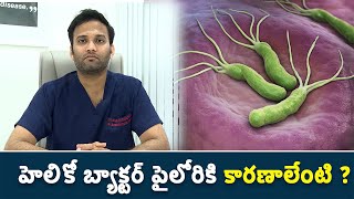 Causes Of Helicobacter Pylori  హెలికో బ్యాక్టర్ పైలోరికి కారణాలేంటి [upl. by Ellatsirhc217]