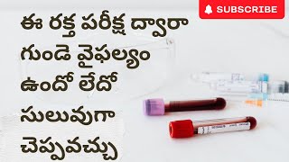 NT PRO BNP BLOOD TEST FOR HEART FAILURE IN TELUGU [upl. by Aven]