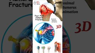 Proximal Humerus Animation  humerus factures animation  humerus animation  BiologywithAliya [upl. by Honniball]