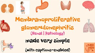 Membranoproliferative glomerulonephritis  MPGN  Renal system  Pathology  Med Vids made simple [upl. by Aicitel]