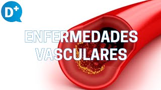 Consejos para prevenir las enfermedades vasculares [upl. by Kannry971]