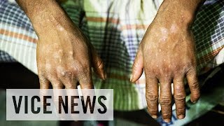 Toxic Tanneries Poisoning Workers in Bangladesh [upl. by Asseniv856]