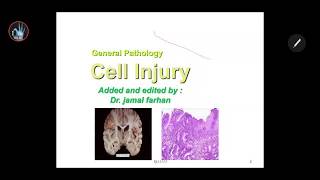 General pathology Introduction  cell injury علم الأمراض  مقدمة  الاذية الخلوية [upl. by Otanutrof632]