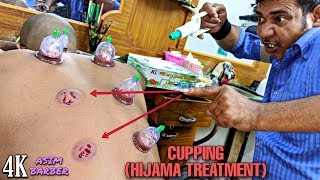 Hijama Treatment For Dead Cells  Cupping Technique By Asim  Neck Cracking  ASMR 4K [upl. by Gothar]