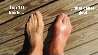 Top 10 foods that cause gout [upl. by Anitak826]