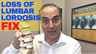 Can Loss Of Lumbar Lordosis Be Fixed Without Surgery  Dr Walter Salubro Chiropractor in Vaughan [upl. by Erdnoed]