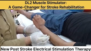 DL2 Muscle Stimulator A GameChanger for Stroke Rehabilitation [upl. by Mohn675]