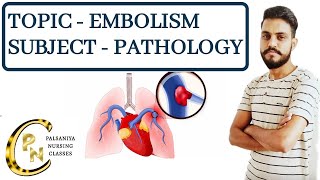 EmbolismDefinitiontypesPathogenesis Clinical manifestations Embolism in hindi by Palsaniya Sir [upl. by Leamsi534]