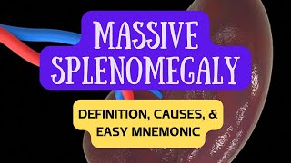 Massive Splenomegaly Enlarged Spleen  Definition Causes and Easy Mnemonic [upl. by Etnomed]