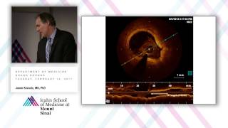 Defining the Cause of FMD and Redefining Our Understanding of Spontaneous Arterial Dissection [upl. by Clarke]