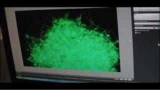 Lyme Biofilm [upl. by Nebe]