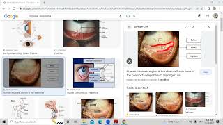 Conjunctiva lecture one [upl. by Lachish843]