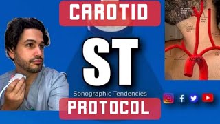 Carotid DuplexDoppler Protocol [upl. by Goodard]